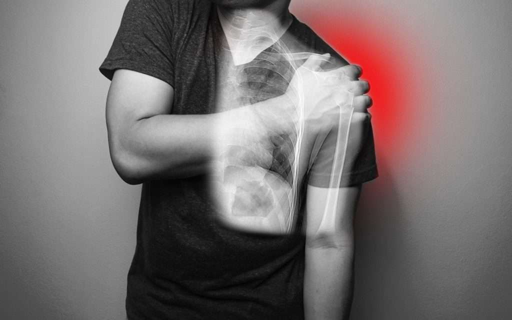 dislocated shoulder