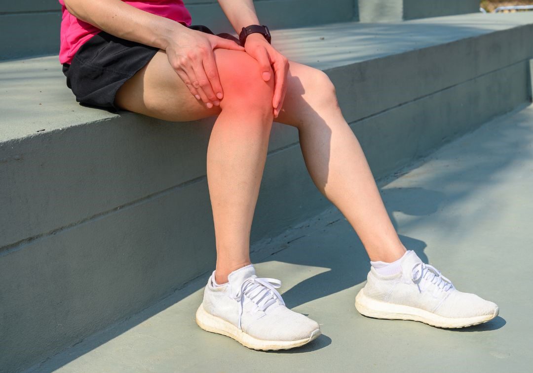 Understanding Iliotibial Band Syndrome: A Comprehensive Guide to Lateral Knee Pain